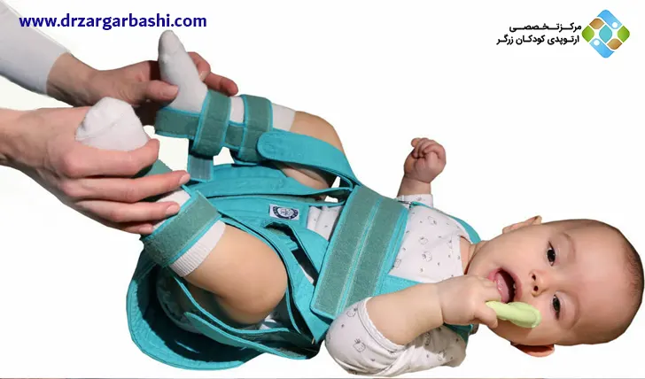 درمان دیسپلازی هیپ در کودکان با آتل