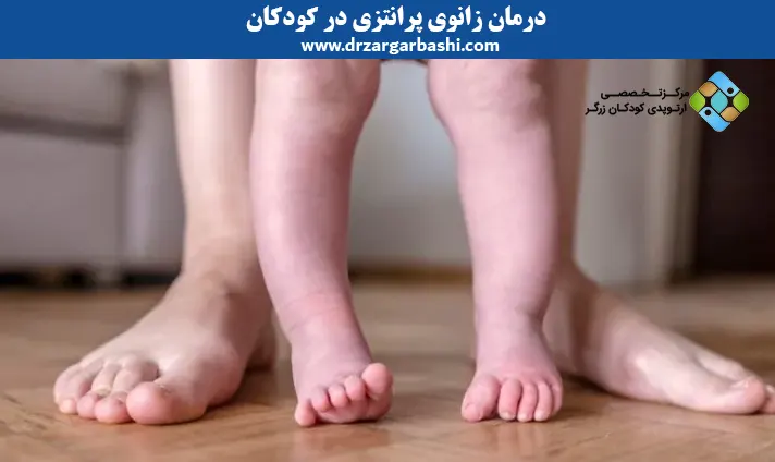 درمان زانوی پرانتزی در کودکان