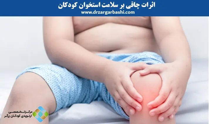 اثرات چاقی بر سلامت استخوان کودکان