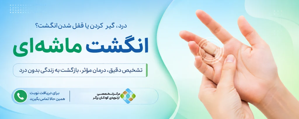 انگشت ماشه ای دریافت نوبت