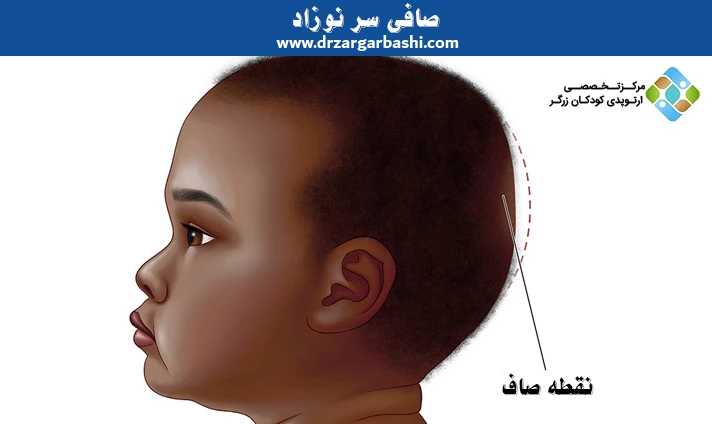 صافی سر نوزاد