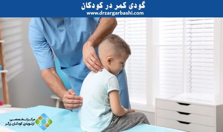 گودی کمر در کودکان