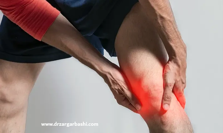 علل سندروم باند ایلیوتیبیال