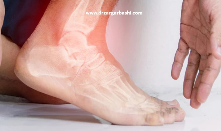 علائم سندرم تونل تارسال