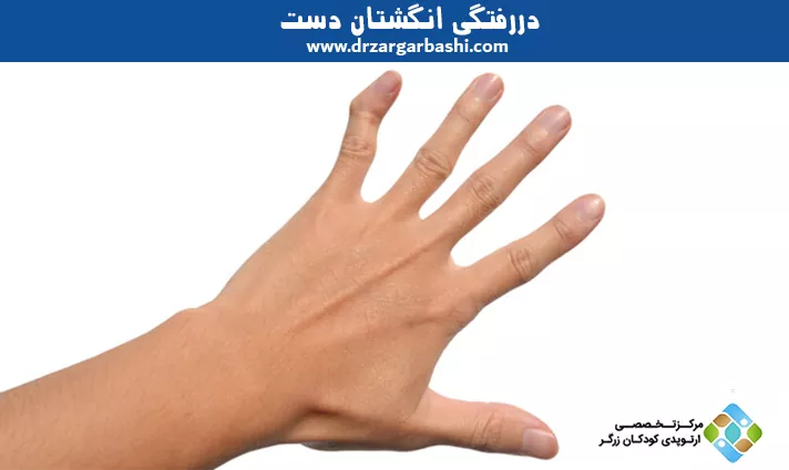 دررفتگی انگشتان دست