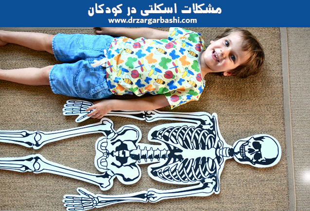 مشکلات اسکلتی در کودکان