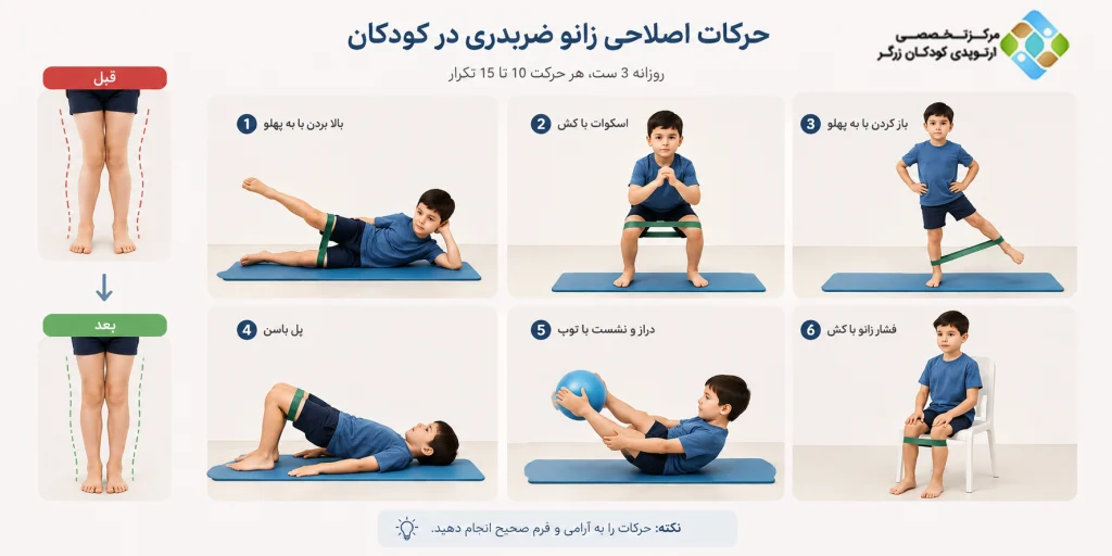 حرکات اصلاحی کششی و تقویتی زانو ضربدری کودکان