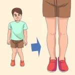 ضرورت انجام حرکات اصلاحی زانو ضربدری کودکان