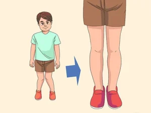 ضرورت انجام حرکات اصلاحی زانو ضربدری کودکان