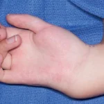 رادیال کلاب هند