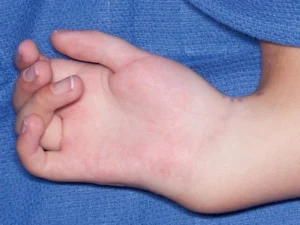 رادیال کلاب هند