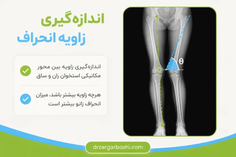 نمای توضیحی درباره اندازهگیری زاویه انحراف