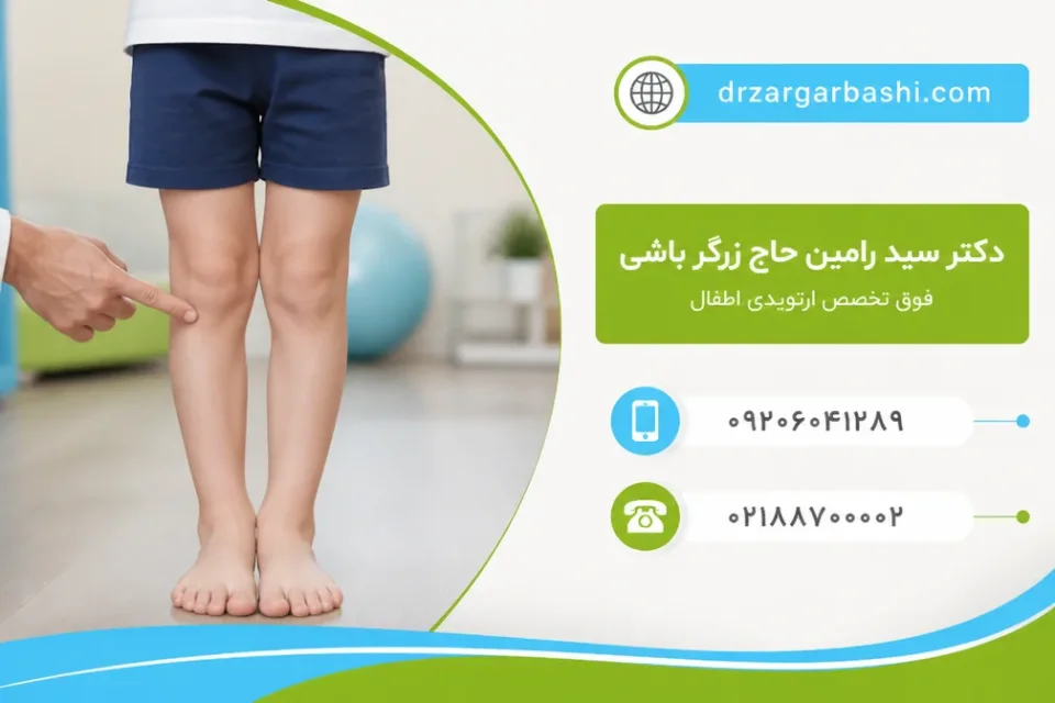 نمای توضیحی درباره معاینه فیزیکی برای تشخیص زانوی پرانتزی