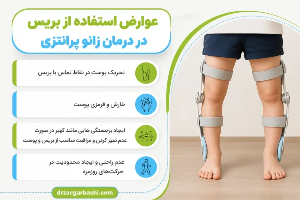 نمای توضیحی درباره عوارض استفاده از بریس در درمان زانو پرانتزی